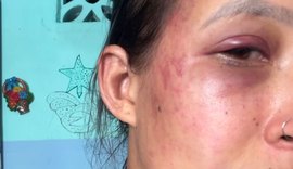 Mulher denuncia companheiro por violência doméstica após recusar ter relação sexual