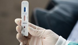 Municípios precisam comprovar uso de testes rápidos para solicitação de novos lotes