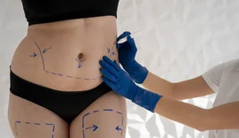 Brasil é o país que mais realiza cirurgia plástica no mundo