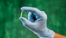Planos de saúde terão de oferecer implante contraceptivo hormonal