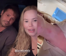 Namorada de Dado Dolabella formaliza denúncia e diz ter sido coagida a negar agressões