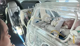 Bebês cardiopatas de Maceió são transferidos para cirurgia em São Paulo