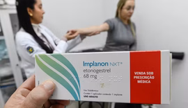 Implante contraceptivo de R$4 mil deve ser ofertado por planos a partir de hoje