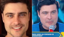 Ex galã da Globo chama atenção na web: 'Desarmonização'