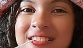 Menina de 9 anos que teve 75 % do corpo queimado morre no HGE