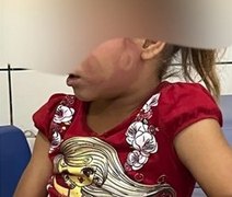 Justiça mantém prisão de homem acusado de agredir a própria filha com chineladas no rosto no interior de AL