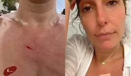 Esposa de William Bonner, é assaltada enquanto andava de bicicleta e fica ferida no Rio