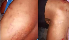 Família pede Justiça após jovem ser agredido por Guarda Municipal em São José da Laje