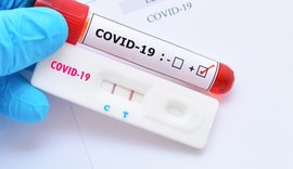 Planos de saúde serão obrigados a cobrir testes para Covid-19