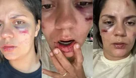 Mulher é arremessada de montanha-russa em parque aquático recém-inaugurado: ‘Desesperador’