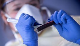 Teste para covid-19 sai da lista obrigatória de cobertura dos planos de saúde