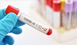 Estado registra 709 novos casos e 19 óbitos pela covid
