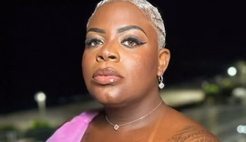 Jojo Todynho mostra antes e depois de perda de 53 kg após bariátrica
