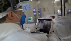 AL tem menor número de mortes por Covid-19 em 2 meses