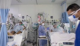 Neurologistas identificam derrame em pacientes com menos de 50 anos infectados por novo coronavírus