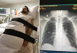 Cientista da UFRJ cria proteína que pode recuperar movimentos após lesão na medula