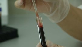 Brasil testará tratamento com plasma sanguíneo em pacientes com Coronavírus