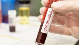 Alagoas confirma mais 551 casos da covid-19 em 24 horas