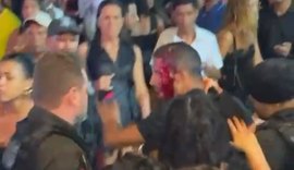 Vídeo: Homem é ferido na cabeça por guarda municipal durante show em Atalaia