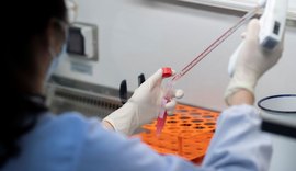 Estudo feito pelo Unicamp aponta a probabilidade do covid de infectar as células adiposas