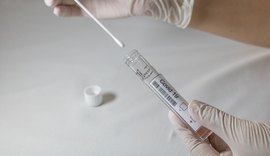 Boletim: Alagoas registra mais 779 casos de covid-19