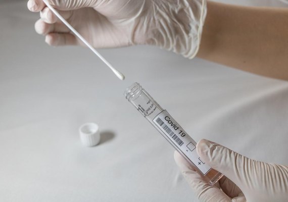 Boletim: Alagoas registra mais 779 casos de covid-19