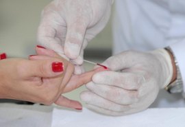 Projeto promove neste sábado (21) testagem itinerante de HIV em Maceió