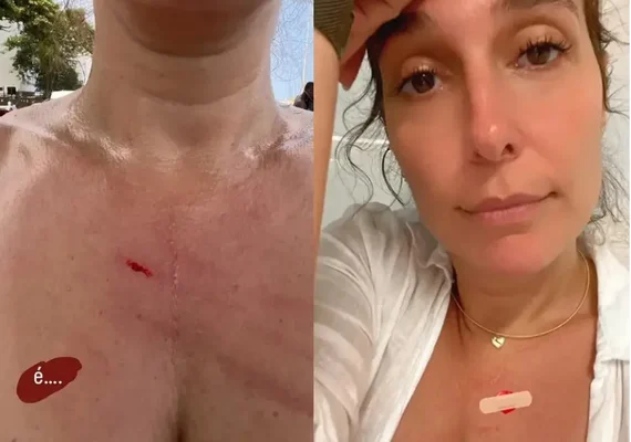 Esposa de William Bonner, é assaltada enquanto andava de bicicleta e fica ferida no Rio