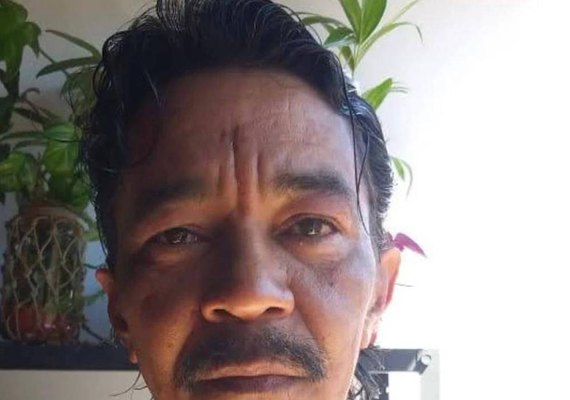 Morre sobrevivente do acidente com césio-137 em Goiás após décadas