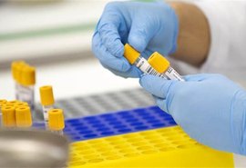 OMS precisa de R$ 170,9 bilhões para combate à covid-19