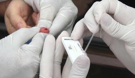Covid-19: Pesquisa nacional de testagem da população terá nova etapa em Maceió