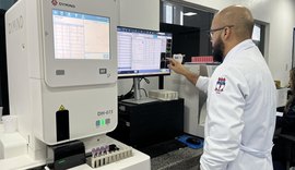 HGE passa a contar com novo equipamento capaz de realizar 100 hemogramas por hora