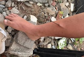 Criança tem perna perfurada por vergalhão em terreno baldio de Arapiraca