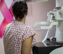 Mais de 1900 exames gratuitos de mamografia e citologia serão ofertados em Alagoas