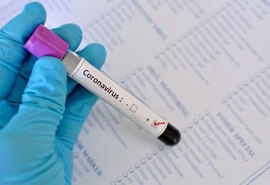 Brasil tem mais de 1 milhão de casos confirmados de Covid-19