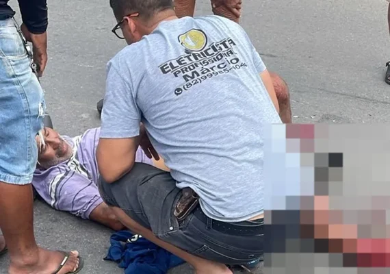 Idoso tem perna esmagada após colisão com ônibus na AL-110 em Arapiraca