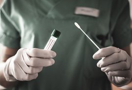 TCU diz que governo atrasa compra de testes para a covid-19 há 4 meses