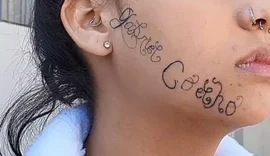 Ex-namorado tatua o próprio nome no rosto de menina à força