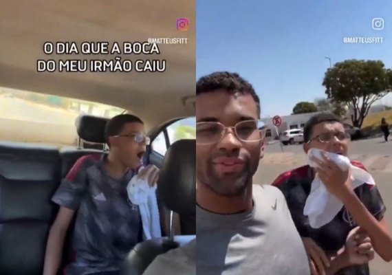 Um simples bocejo termina em hospital após adolescente deslocar a mandíbula