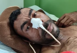 Hospital do Agreste procura familiares de homem internado após acidente de moto