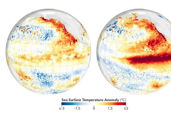 Frio e El Niño aumentam alerta para doenças respiratórias infantis no Brasil