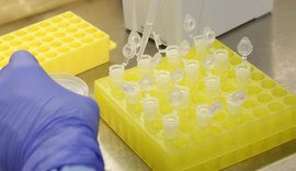 Britânicos que produzem vacina farão testes com 10 mil pessoas