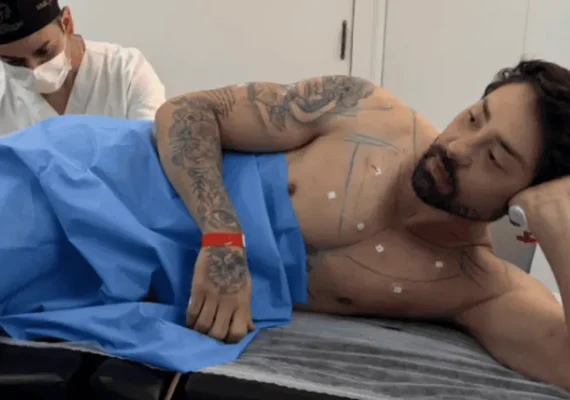 Rico Melquiades revela “cutox” e médico alerta sobre uso da toxina
