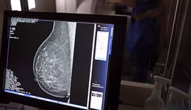 Entenda como IA identifica risco de doenças cardíacas em mamografias