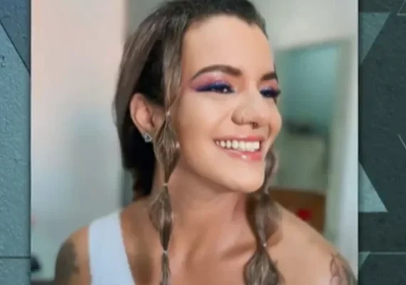 Vítima de espancamento em elevador teve lesão como se sofresse acidente de moto sem capacete