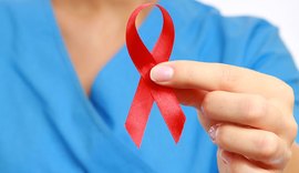 Teste dá nova esperança sobre eficácia da imunoterapia contra Aids