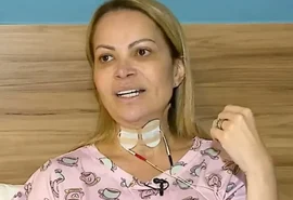 Solange Almeida revela problema de saúde causado por uso de vapes