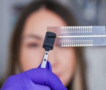 Pesquisadores criam chip que identifica 32 doenças de uma vez; veja