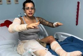 “Não morri porque ele me salvou”, diz mulher após incêndio em kitnet em Maceió