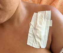 Seis casos de violência contra a mulher são registrados em Alagoas